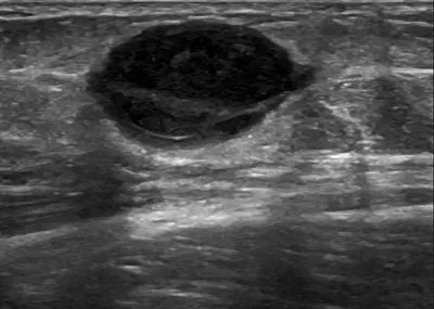 Neuroma - The Lemon Sign